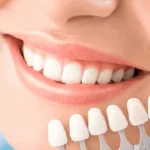 Choosing the Right Dentist for Your Cosmetic Dentistry Needs
