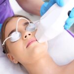 Laser Treatment for Acne Scarring