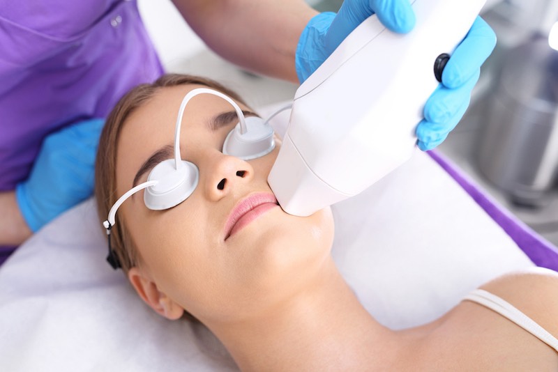 Laser Treatment for Acne Scarring