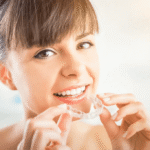 Steps Involved in the Invisalign Process