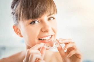 Steps Involved in the Invisalign Process