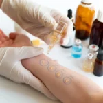 The Benefits of Allergy Testing for Identifying Triggers