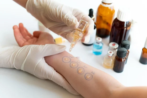 The Benefits of Allergy Testing for Identifying Triggers
