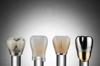 The Various Materials Used in Dental Crowns