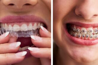 Understanding Different Orthodontic Treatments Available Today