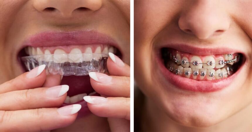 Understanding Different Orthodontic Treatments Available Today