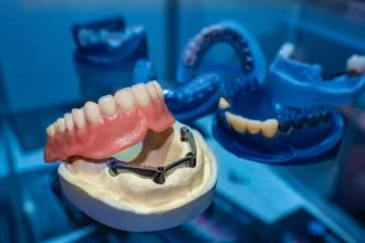 Why Dental Implants Are Considered the Gold Standard in Tooth Replacement