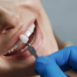 Regular Dental Check-ups After Getting Veneers
